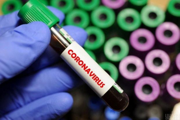 Dünyada koronavirusdan ölən jurnalistlərin sayı