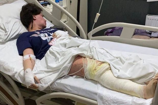 Aysel Şükürovanın keçmiş əri onun partlayışdan sonrakı vəziyyətindən