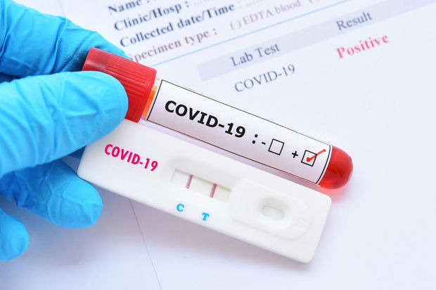 Dünyada son həftə qeydə alınan qorxulu koronavirus statistikası