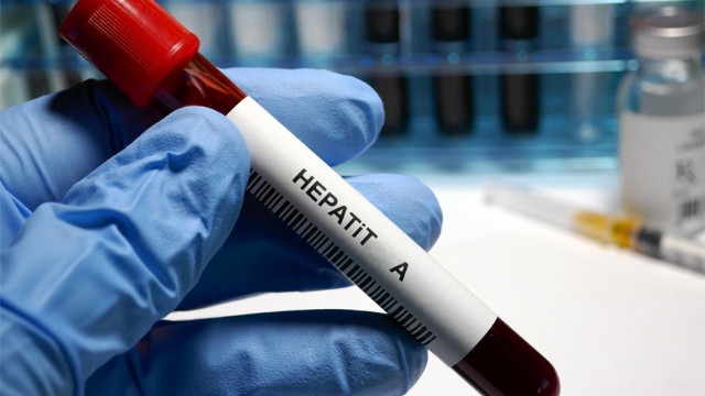 Azərbaycanda hepatit A virusunun yayılması ilə bağlı