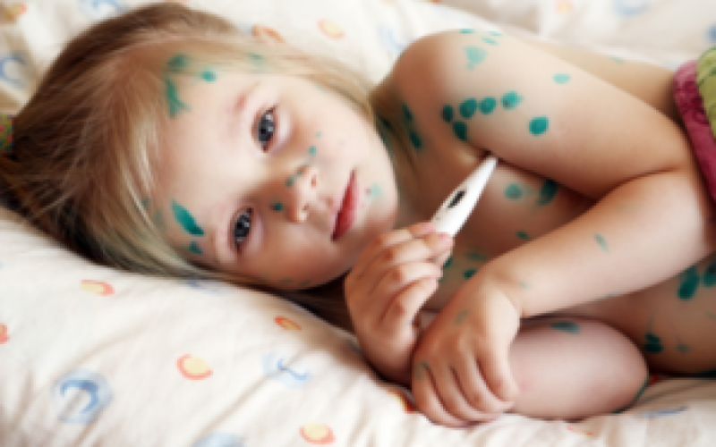 Su çiçəyinə yoluxmada artım olub