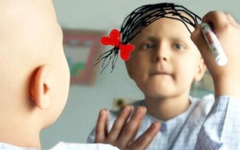 "Uşaqlar arasında onkoloji xəstələrin sayı 2 dəfə artıb" -