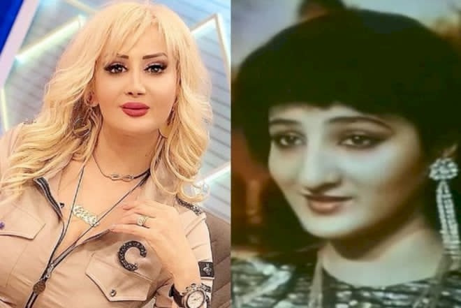 Xalq artisti: “Estetik əməliyyat insanı gözəlləşdirmir”