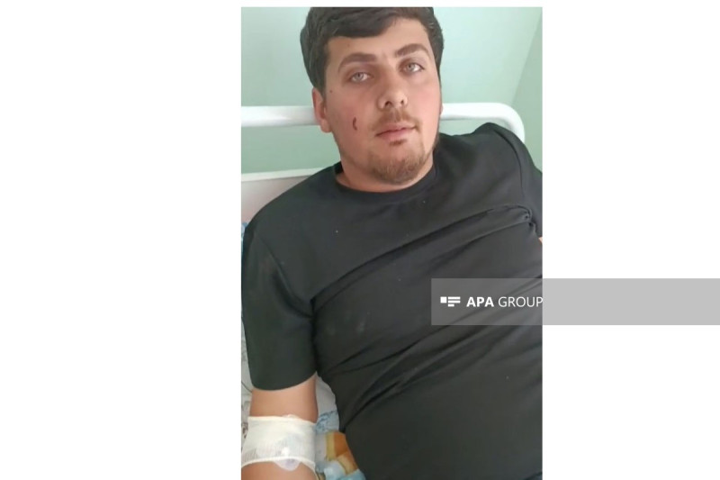 Dron hücumunda yaralanan həmyerlimiz: